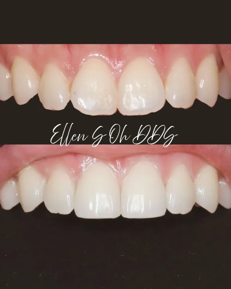Ellen S Oh DDS