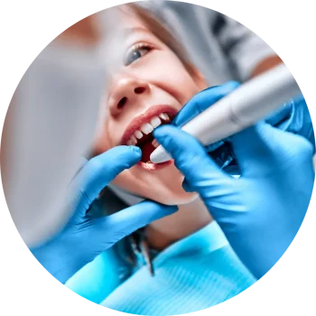 What Are Dental Sealants