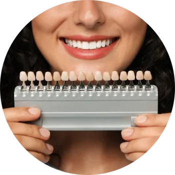 What Are Dental Veneers